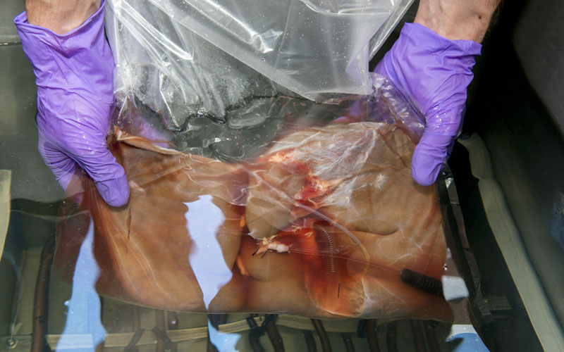 A human liver in a clear bag with air removed and submerged in liquid