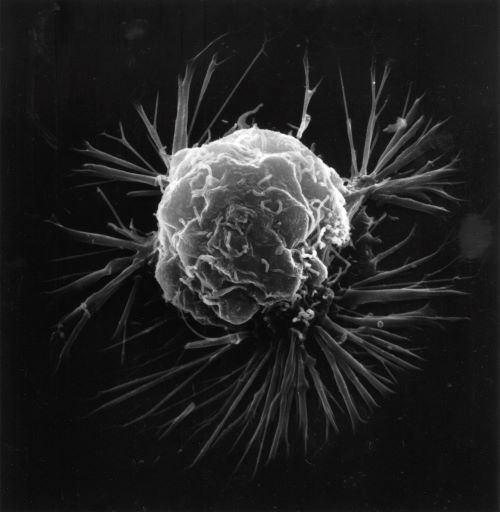 Grey cancer cell on a black background