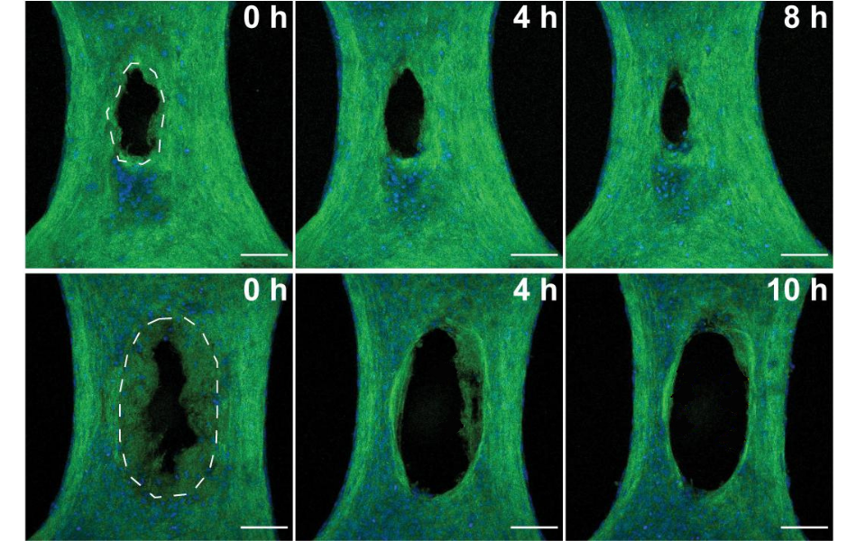 discovery-of-skin-cell-function-could-open-doors-to-improved-burn-healing