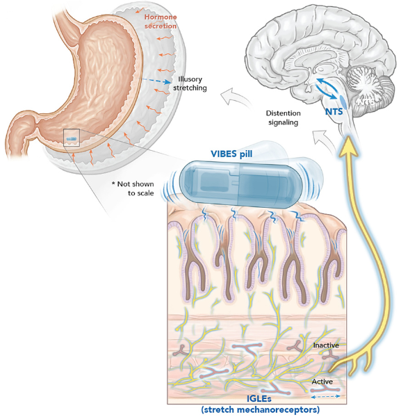 illustration of vibrating pill activation in stomach