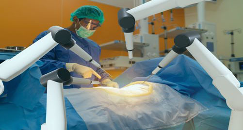 Performing robotic surgery 