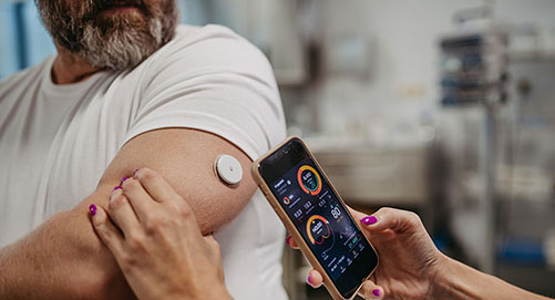 Man wearing a continuous glucose monitor transmitting data to phone