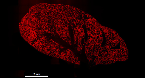 Microscopy image of mouse lung with widespread red fluorescence 