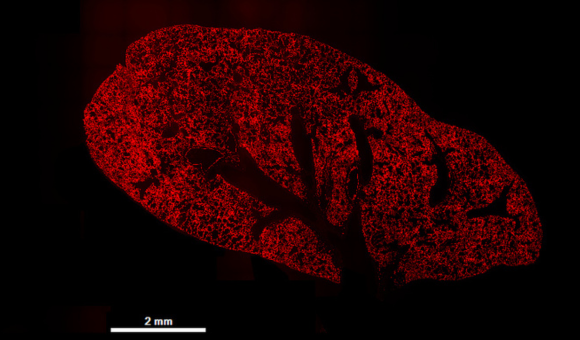 Microscopy image of mouse lung with widespread red fluorescence 