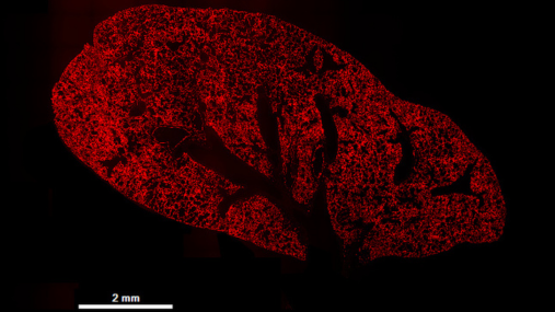 Microscopy image of mouse lung with widespread red fluorescence 