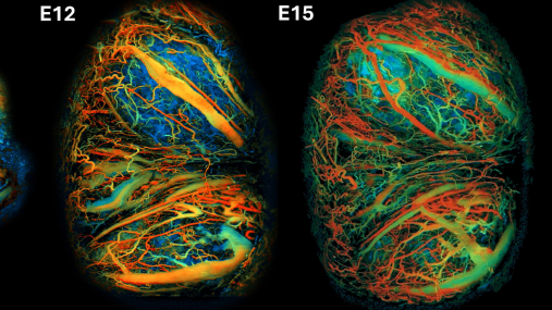 Photoacoustic microscopy images of a developing mouse placenta