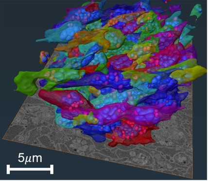 image generated by scanning electron microscope and machine learning