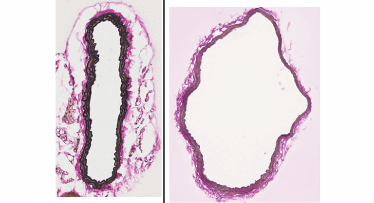 Two cross-sectional tissue stain images of mice arteries