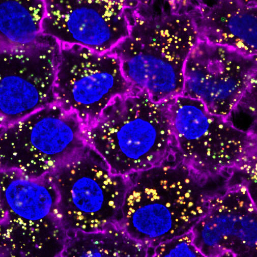 microscopic image of layer-by-layer nanoparticle entering cancer cells