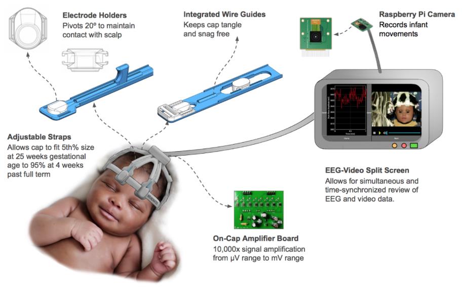 A schematic of the BabyWaves Monitor with a description of how each part works.Electrode Holders: Pivots 20 degrees to maintain contact with scalpAdjustable Straps: Allows the cap to fit 5th% size at 25 weeks gestational age to 95% at 4 weeks past full term. Integrated Wire Guides: Keeps cap tangle and snag freeRaspberry Pi Camera: Records infant movementsEEG-Video Split Screen: Allows for simultaneous and time-synchronized review of EEG and video dataOn-Cap Amplifier Board: 10,000x signal amplification from micro V range to milli V range