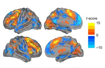 Image maps of the brain