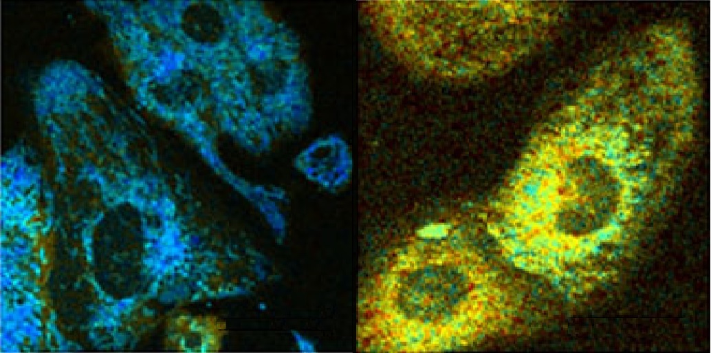 Heart muscle cells with disrupted energy production Heart muscle cells with disrupted energy production