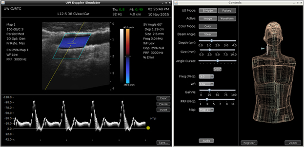 Duplex ultrasound display