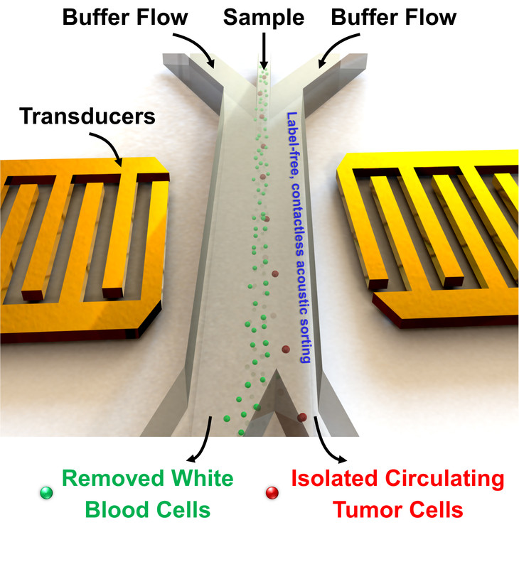 schematic of acoustic tweezers separation of cancer cells from blood cells