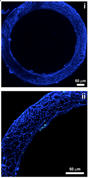 Image of a blue stained circular bone marrow