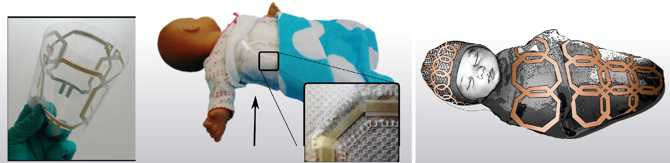 A photo of the flexible MRI coil, a photo of the coil wrapped around a doll, and a drawing showing the coils in a blanket and hat wrapped around a baby.