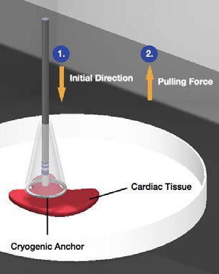 A diagram of the simultaneous cryoanchoring project