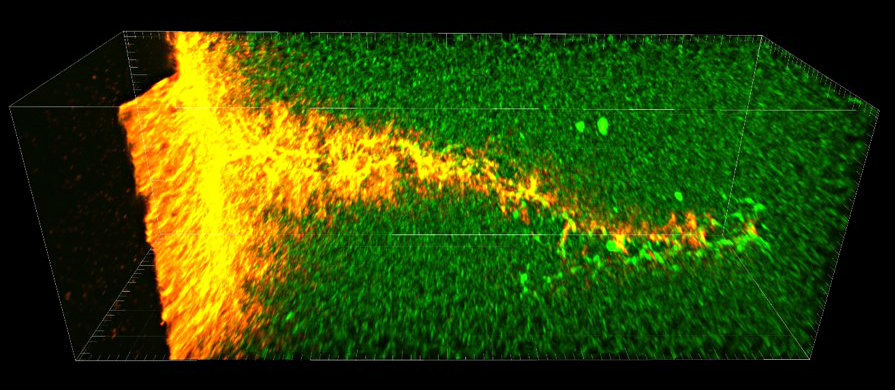High speed photograph of canal made in a fibrin clot by an activated microbubble.