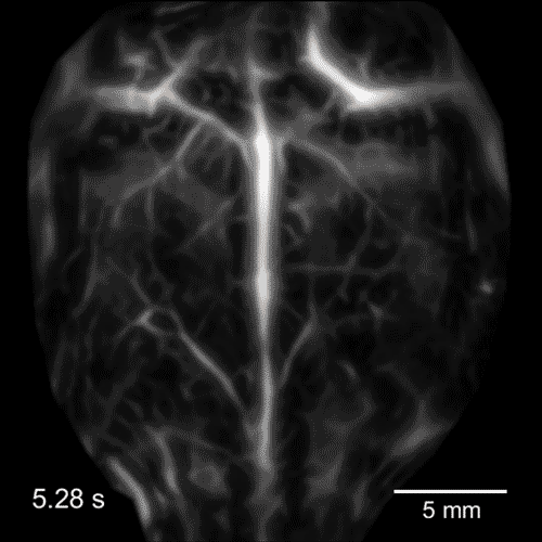 Photoacoustic imaging tracks neurons firing in a live mouse’s brain in response to changing oxygen levels Photoacoustic imaging tracks neurons firing in a live mouse’s brain in response to changing oxygen levels