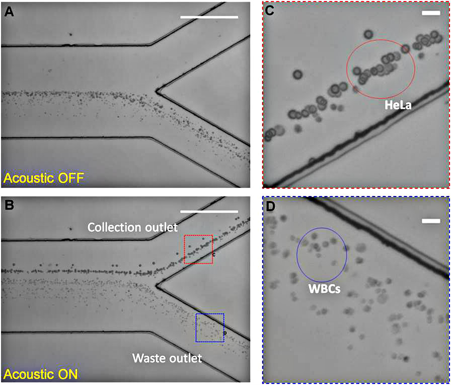 Close up of device with cancer cells separating from white blood cells when sound is turned on.