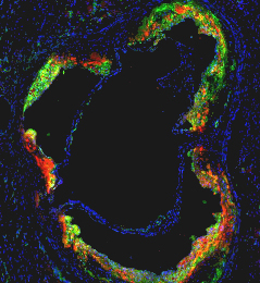 Image of a blood vessel with red nanoparticles with a statin drug treating green inflammatory macrophage cells