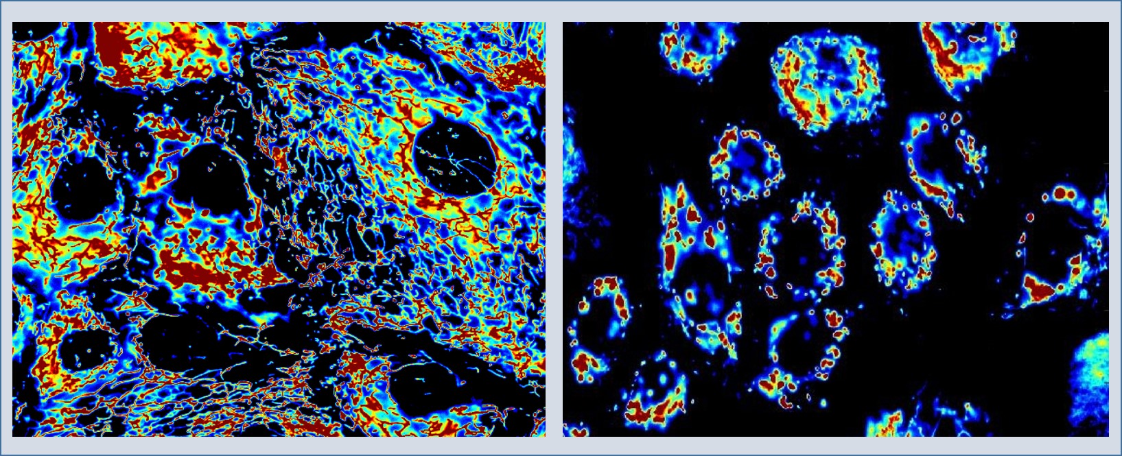 verschil in mitochondriale celverdeling in normale versus kankercellen