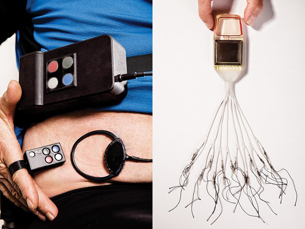 Electrodes and transponder for Team Cleveland system