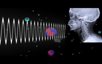 X-rays | National Institute Of Biomedical Imaging And Bioengineering