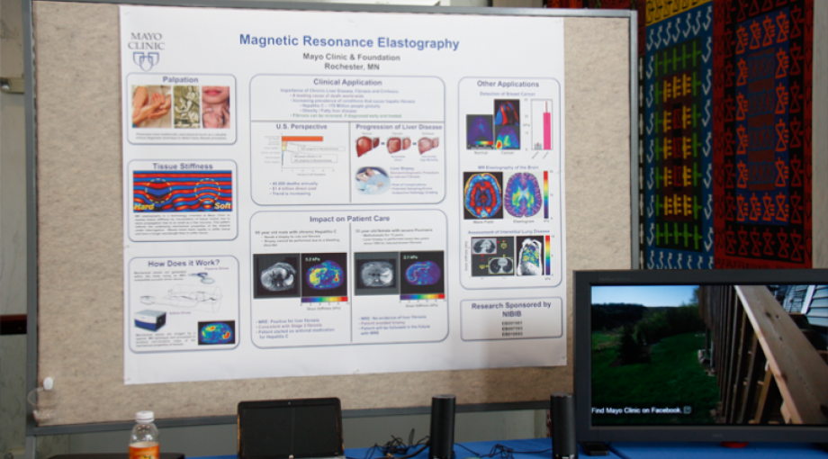 Mayo Clinic’s Magnetic Resonance Elastography (MRE) is a new imaging technology that uses low-frequency mechanical vibrations to assess tissue stiffness and to non-invasively diagnose liver fibrosis. MRE is safer, more comfortable, less expensive, and more accurate than a biopsy.